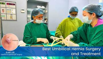 best Umbilical Hernia surgeon in Delhi